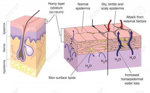 44912780-Section-through-skin-showing-normal-epidermis-and-skin-surface-structure-resulting-in-water-loss-and-Stock-Vector